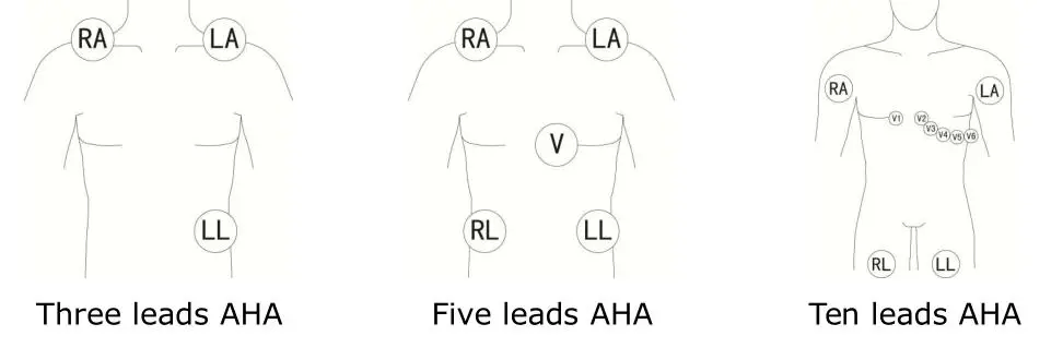 Yhteensopiva Colin 5-lyijypihdistin IEC ECG Leadwire -sarja, ryhmä 40in & 6PIN