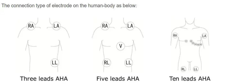 5-johtimet EKG-johtimet Philips digitrak plus 24 tunnin holter 3100A, 5-lead, Snap